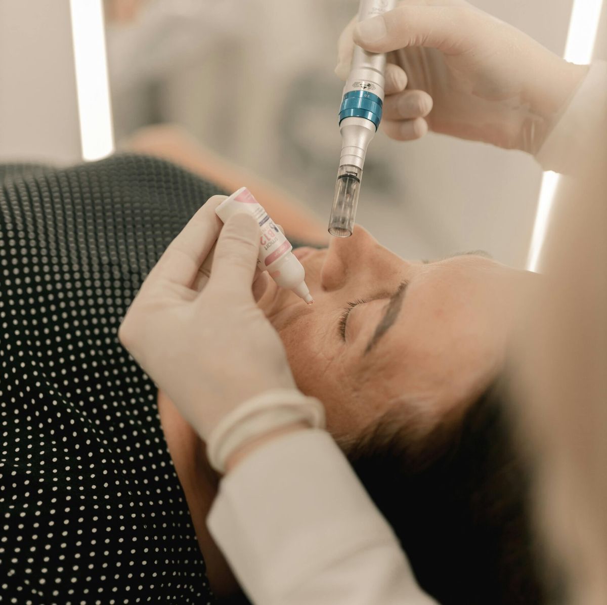Microneedling-Behandlung im Gesicht